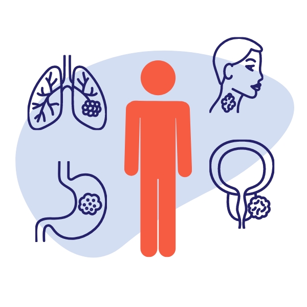 Prostate and lung are the most common types of cancers among males in Canada
